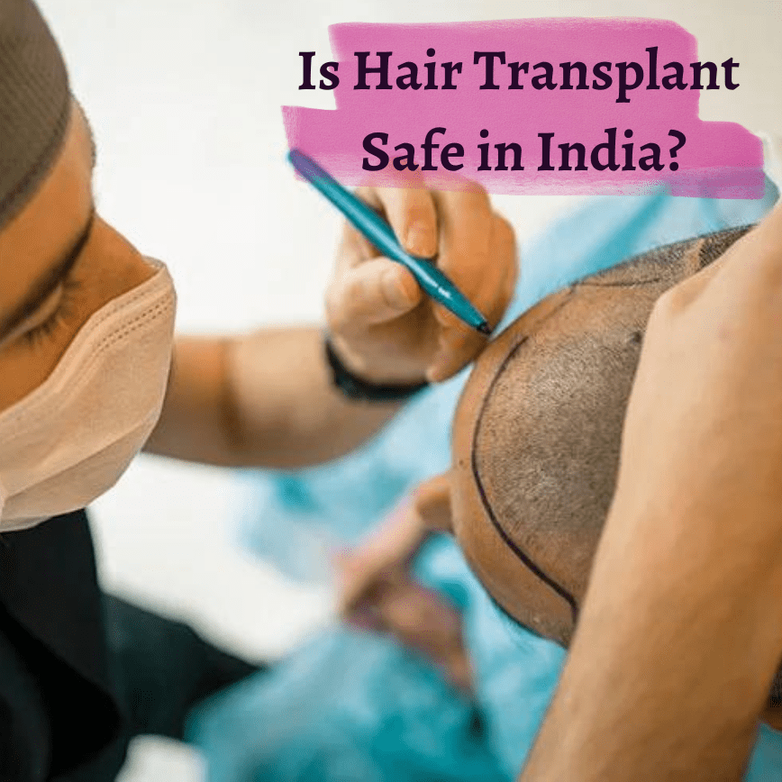 Is-hair-transplant-safe-in-India