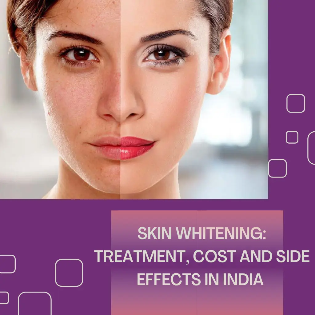 SKIN-WHITENING-TREATMENT-COST-AND-SIDE-EFFECTS-IN-INDIA-1
