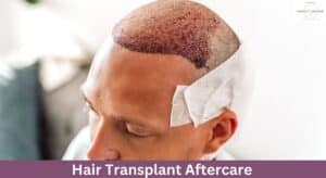 Hair Transplant Aftercare