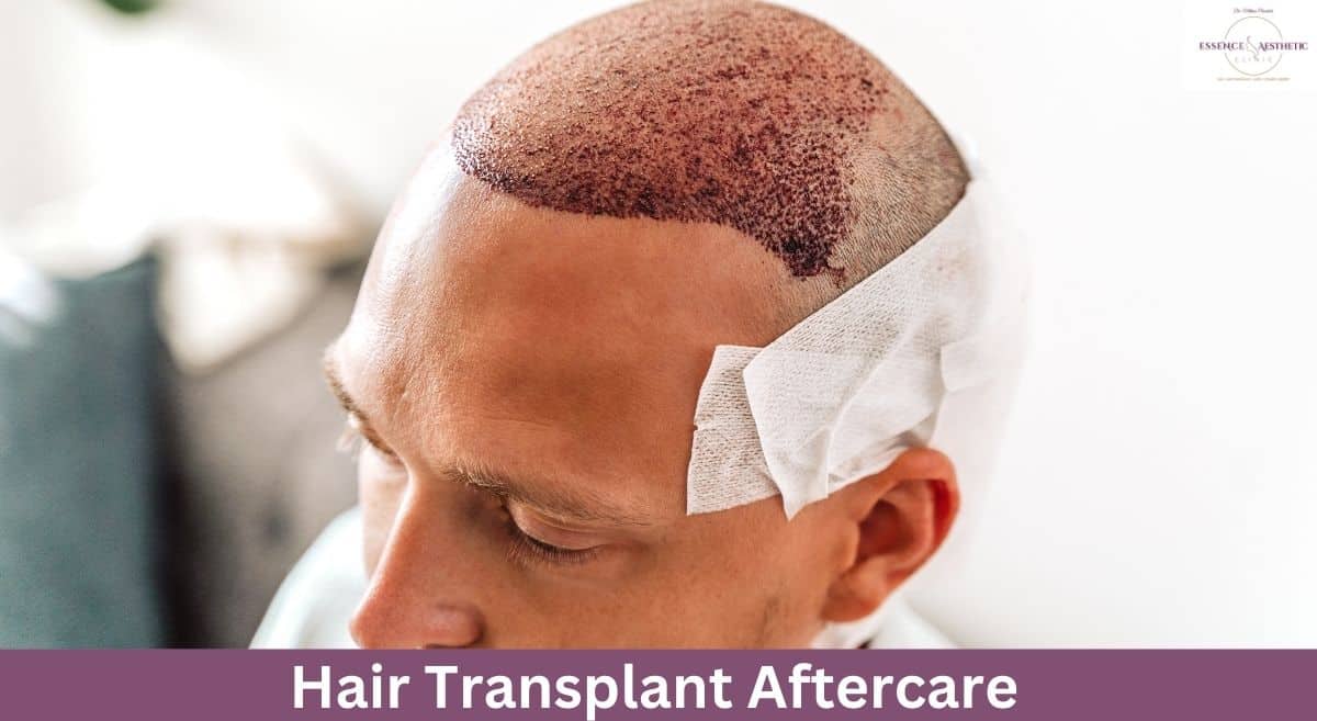 Hair Transplant Aftercare