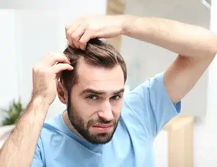 Hair Transplant surgery