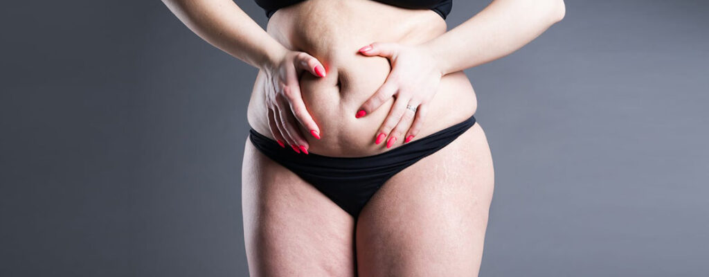 Tummy tuck surgery