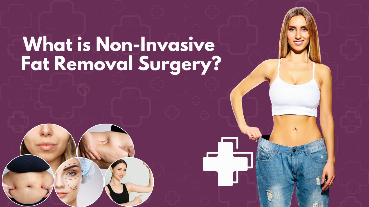 What is non invasive fat removal surgery image